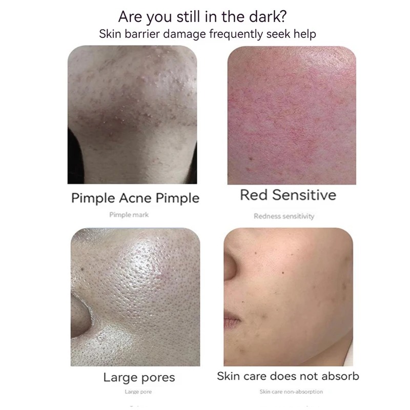 凍結乾燥パウダーセット,抗しわエッセンス,毛穴の縮小,にきび - Oligopeptide Wrinkle のレビューと価格